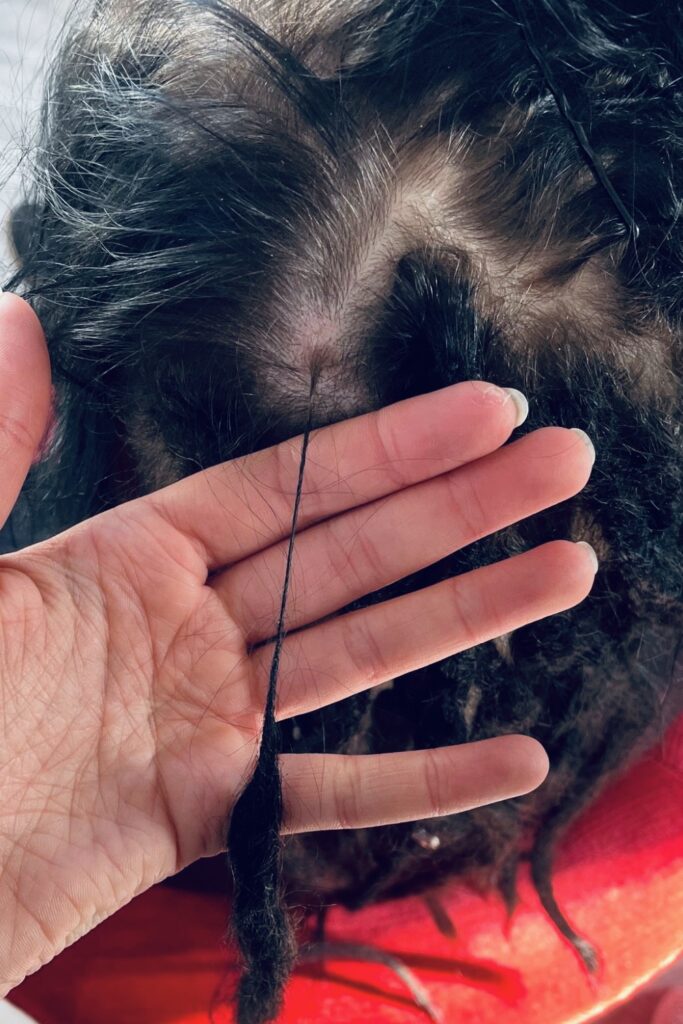 Dreadlocks Rettung